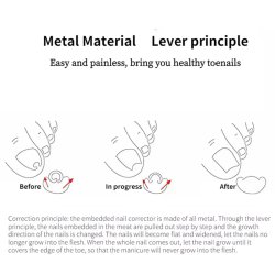 دستگاه اصلاح فرم و ارتودنسی ناخن مدل Nails